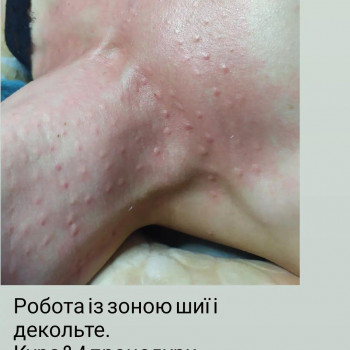 Наталія Захарійчук, Ивано-Франковск Фото - 25