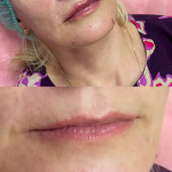 Фото з портфоліо косметолога Марія Соболева (Київ)