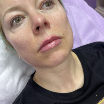 Фото з портфоліо косметолога Марія Соболева (Київ)