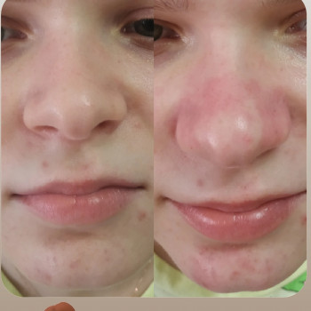 Оксана Татаєва, Одеса Фото - 39