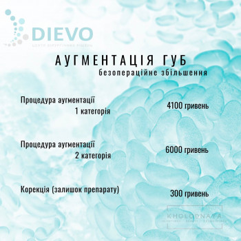 Аліна Холодна, Киев Фото - 7