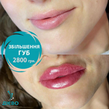 Аліна Холодна, Киев Фото - 5