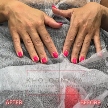 Аліна Холодна, Киев Фото - 4