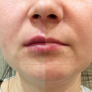 Аліна Холодна, Киев Фото - 3