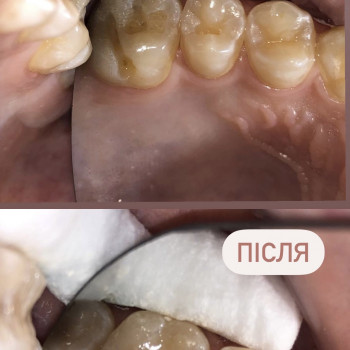 Сергій Бурса, Ужгород Фото - 5