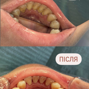 Сергій Бурса, Ужгород Фото - 6