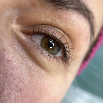 Перед корекцією