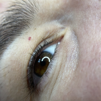 Перед корекцією