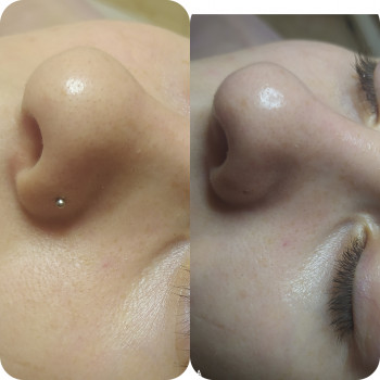 Анна Черная, Одеса Фото - 5