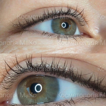 Татуаж глаз перманентный макияж, фото - Косметологический центр МаКо
