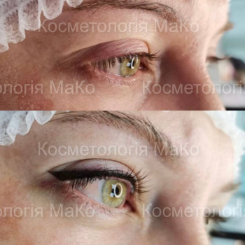 Татуаж глаз перманентный макияж, фото - Косметологический центр МаКо