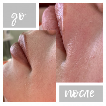 Юлія Горобець, Днепр Фото - 6