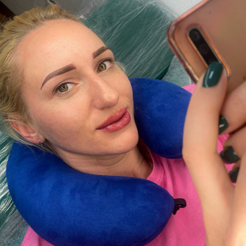 Перманент трьох зон, одразу після процедури