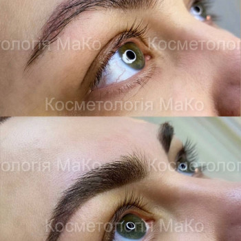 Татуаж брів перманентний макіяж, фото - Косметологічний центр МаКо
