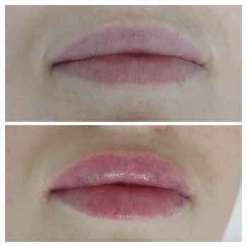 Юлия Злочевская, Белая Церковь Фото - 30