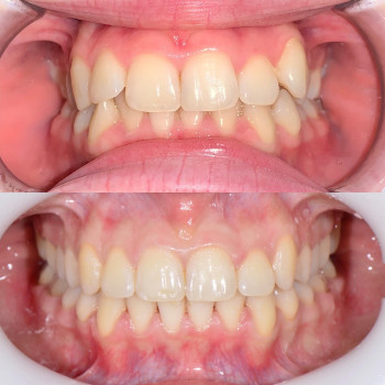 Богдан Токар, Ужгород Фото - 8