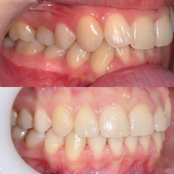 Богдан Токар, Ужгород Фото - 9