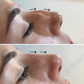 Юлия Хірса, Харків Фото - 77