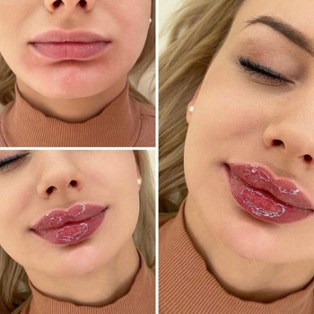 Юлия Хірса, Харків Фото - 48