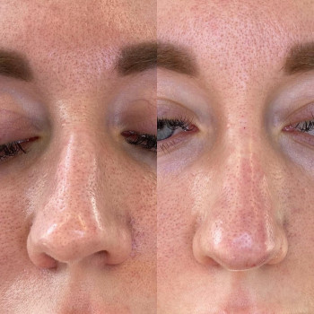 Юлия Хірса, Харків Фото - 71