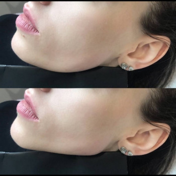 Юлия Хірса, Харків Фото - 72