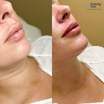 Beauty Hub by Dr. Kupriichuk, Вишневе Фото - 17