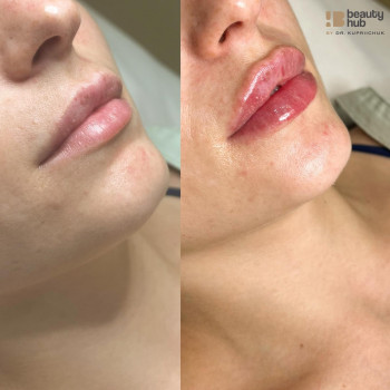 Beauty Hub by Dr. Kupriichuk, Вишневе Фото - 15