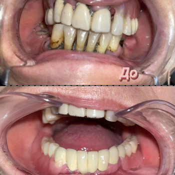 Сергій Бурса, Ужгород Фото - 7