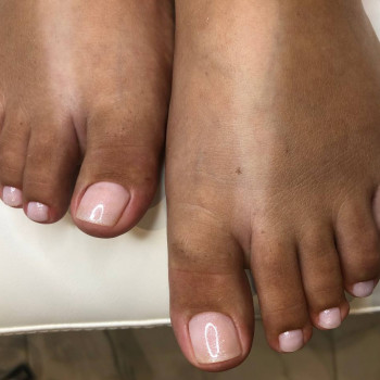 Фото з портфоліо фахівця Юлія Богатир (подолог, Черкаси)