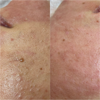 Валерия Сороковая, Харьков Фото - 6