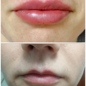 Людмила Кырий, Киев Фото - 21