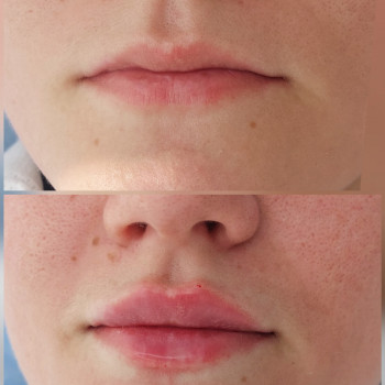 Тетяна Федоришин, Ивано-Франковск Фото - 18