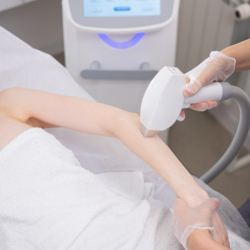 Лазерна епіляція
                    Косметологический центр МаКо Киев