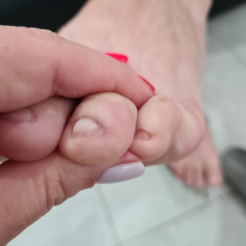 После обработки .