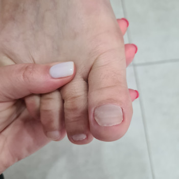 После обработки.