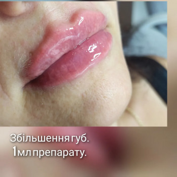 Всі фото без фотошопу