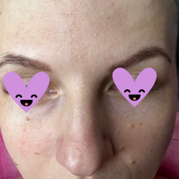 PRX-T33 пілінг
                    Салон краси Atmosfera Krasu Чернівці