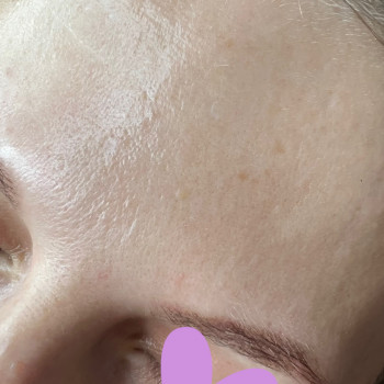 PRX-T33 пілінг
                    Салон краси Atmosfera Krasu Чернівці