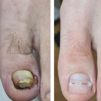 Руслана Петровна Гончарова, Одесса Фото - 34