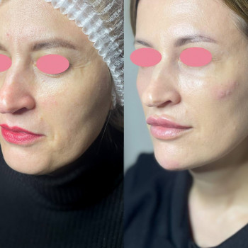 Юлия Микитин, Львів Фото - 14