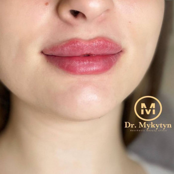 Юлия Микитин, Львів Фото - 21