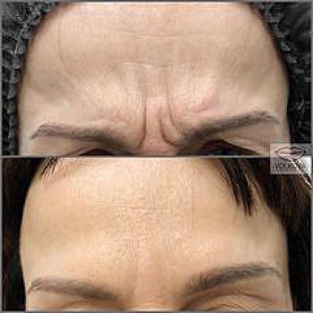 Юлия Волкова, Київ Фото - 5