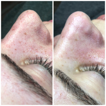 Дарья Северцева, Київ Фото - 6