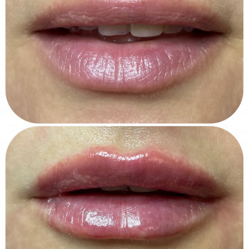 Дарья Северцева, Київ Фото - 7