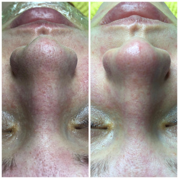 Дарья Северцева, Київ Фото - 10