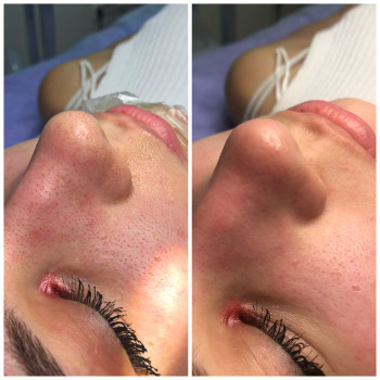 Дарья Северцева, Київ Фото - 12