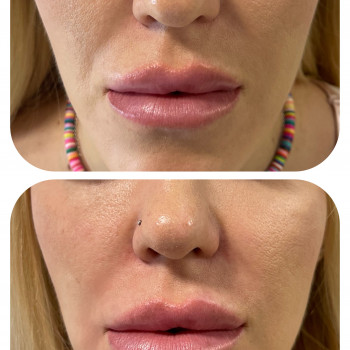 Дарья Северцева, Київ Фото - 15