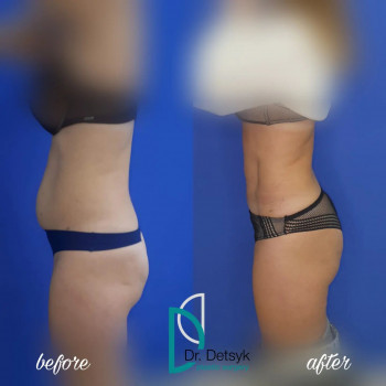 Дмитрий Децык, Запорожье Фото - 5