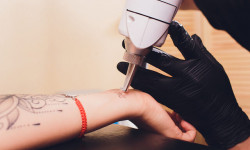 Видалення татуювання з тіла чорного кольору до 50 см кв Тату салон 1000 itattoo Киев