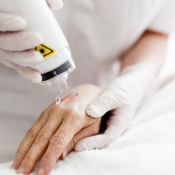 Видалення кольорового татуювання з тіла до 50 см кв
                    Тату салон 1000 itattoo Киев